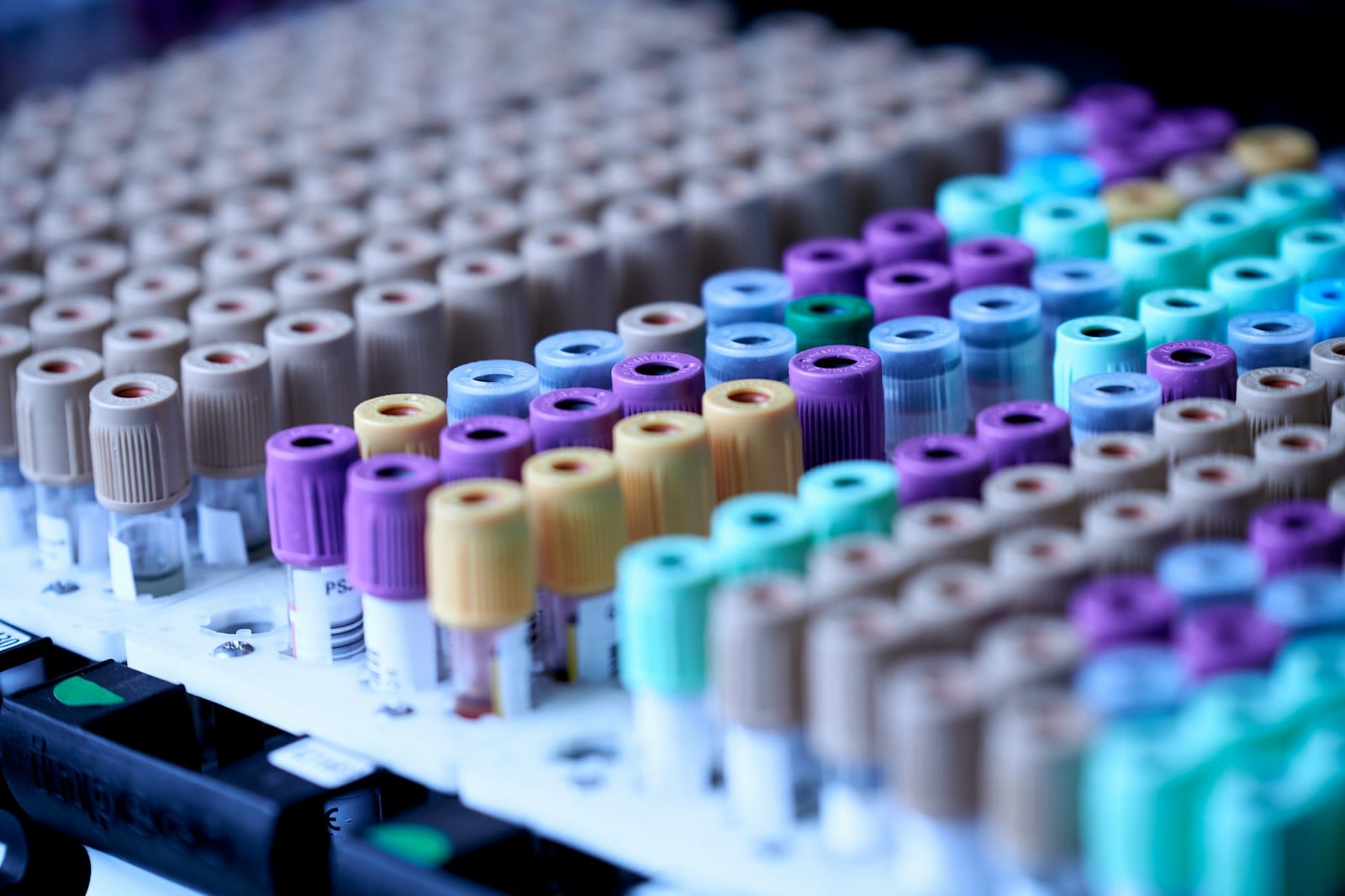 Koleszterin labor: LDL, HDL, triglicerid – mikor veszélyes?